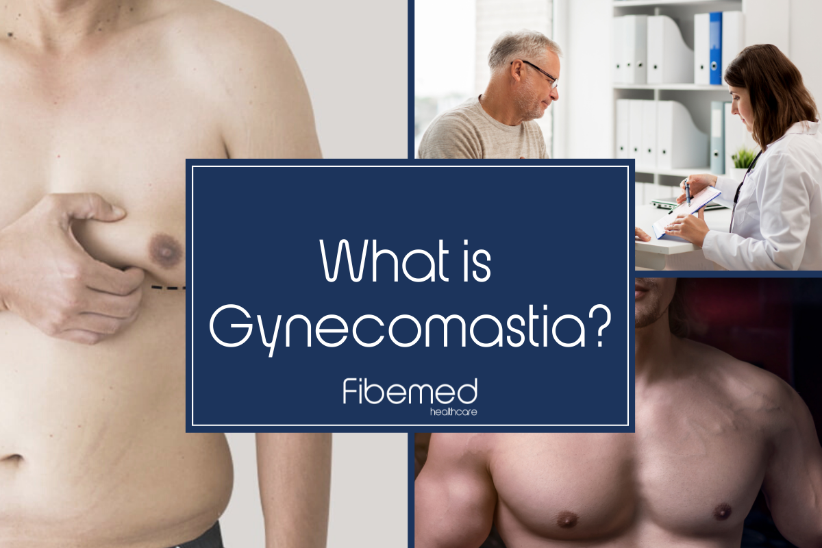 What is Gynecomastia?