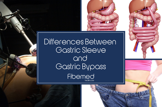 Differences Between Gastric Sleeve and Gastric Bypass in Turkey Fibemed Healthcare